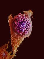 An image of a cancer cell