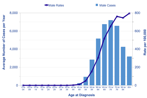 Age-related incidence of prostate cancer