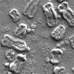 ecDNA and chromosomes seen through a microscope
