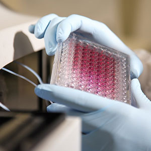 A scientist examining patient samples at an Experimental Cancer Medicine Centre.