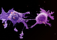 Cancer cells, courtesy of the LRI EM Dept