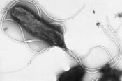 Helicobacter pylori, a major cause of stomach cancer