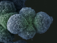 Pancreatic cancer cells (credit: LRI EM Unit)