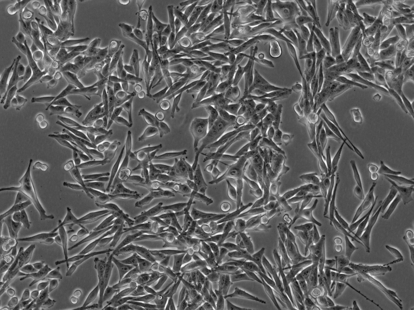 Human melanoma cells Human melanoma cells