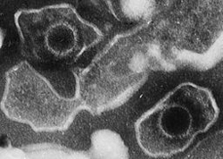 Highly magnified view of EBV virus particles