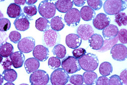 Cells infected with EBV