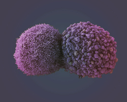 Targeting lunch cancer could benefit other cancers - image from the LRI EM facility
