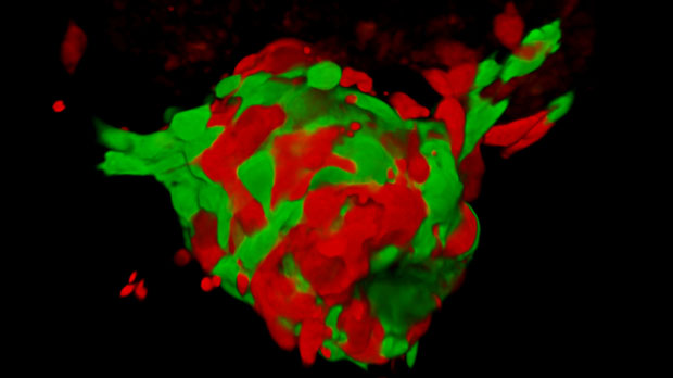 3D reconstruction of melanoma cell tumour in zebrafish embryo