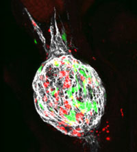 Tumours made of red and green melanoma cells surrounded by a protein meshwork (white).