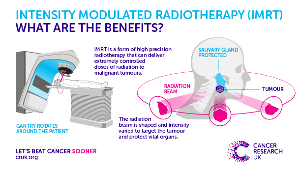 161025-imrt-radiotheraphy-machines-blog