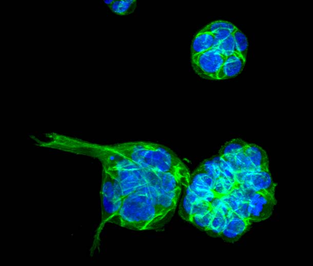 Breast cells
