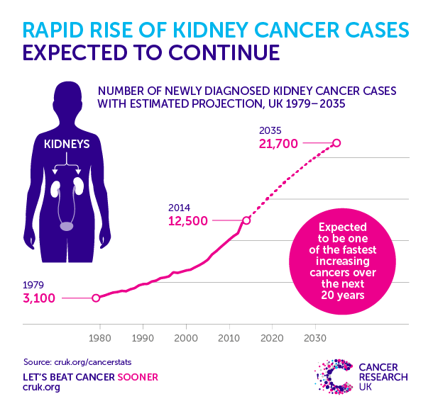 170421-Kidney-cancer-cases-projection-BLOG