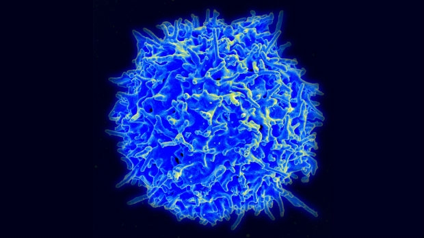 T cell cancer immunotherapy