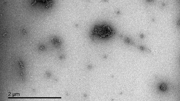 Transmission Electron Microscope image showing tiny oxygen bubbles.
