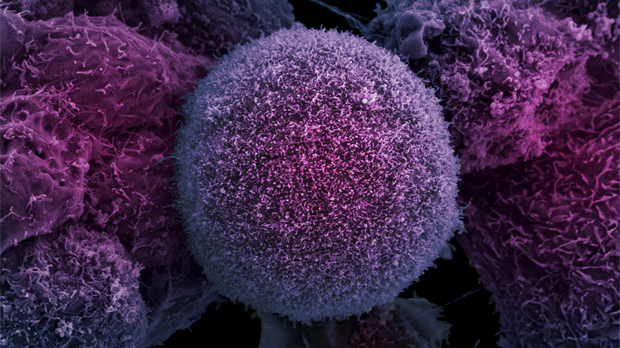 Cancer Cells vs. Normal Cells: How Are They Different?