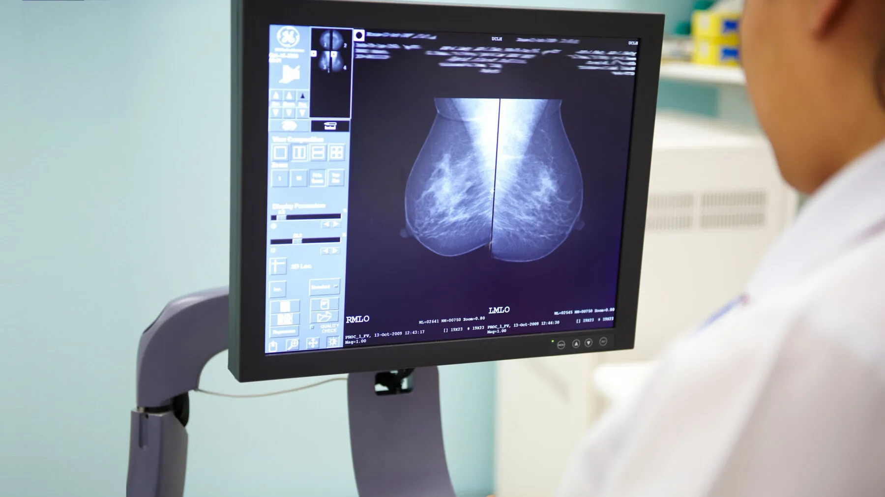 Mammogram