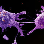 Image of lung cancer cells under a microscope.
