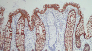 Section of human colon showing sausage-shaped crypts.