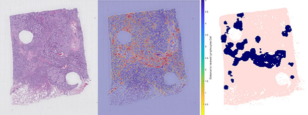 Image showing lung sample stained to reveal immune 'hotspots'