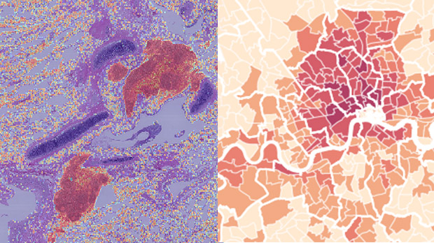 Image of a lung biopsy sample stained to reveal immune 'hotspots' next to a map of London showing crime levels.
