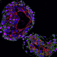 Microscopy image showing a diverse group of prostate cells from mice growing in a 3D ball called an organoid. The fluorescent green and red shows structural proteins called keratins and a tumour marker called P63 appears in pink.