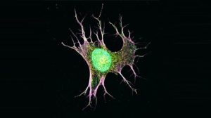 Image of cancer cell.