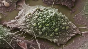 A lung cancer cell