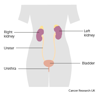 Urine tests: detecting cancer early in pee