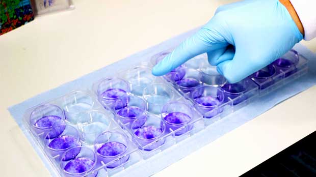 Stephen Taylor's lab, Manchester, testing drug sensitivity