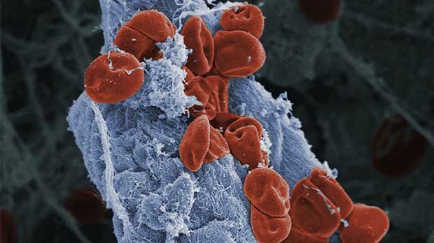 Blood vessel