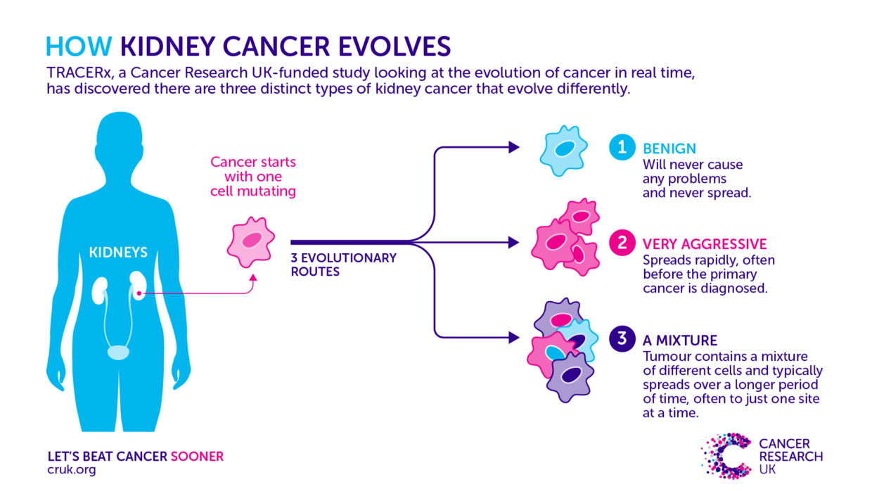 Kidney cancer evolution