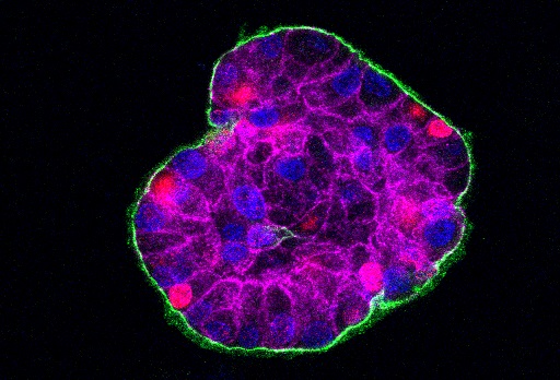 breast precancer cell colony in 3D (credit Dr Gilmore and Simon Saadati