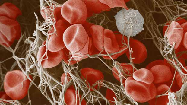 A laboratory image of red blood cells