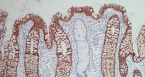 Section of human colon.