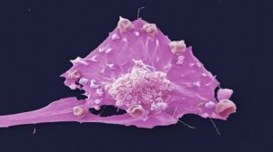 Image of a breast cancer cell