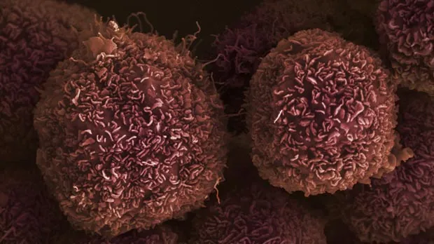 Pancreatic cancer cell