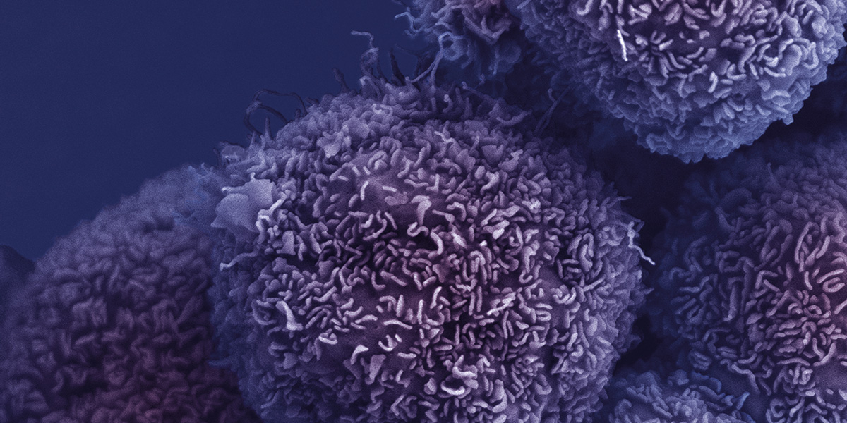 Pancreatic cancer cells - CRUK London Research Institute