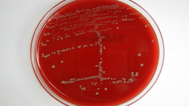 Bacteria growing in a petri dish.