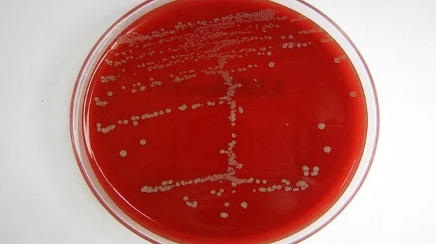 Bacteria growing in a petri dish.