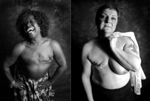 Stand Up To Cancer mastectomy portraits.