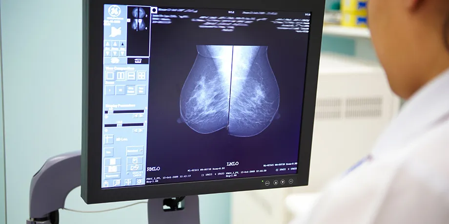 Radiographer looking at mammogram image