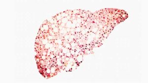 3D illustration showing fatty liver silhouette made from micrograph of liver steatosis