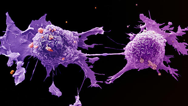 Lung cancer cells