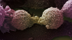 electron microscopy image of two lung cancer cells