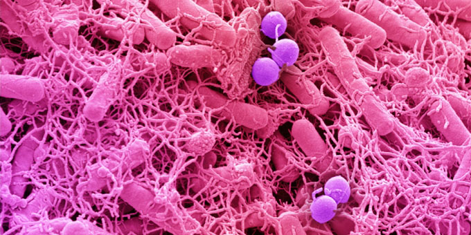 Coloured SEM of bacteria cultured from a fingertip
