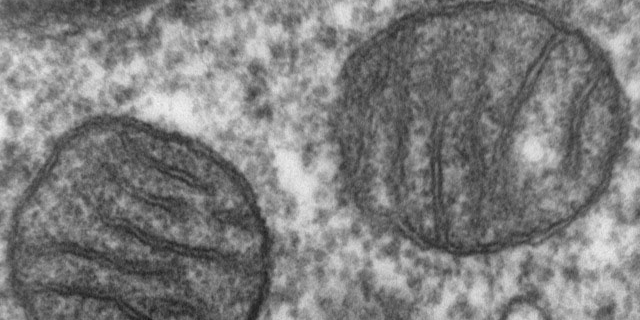 Electron mitograph of mitochondria