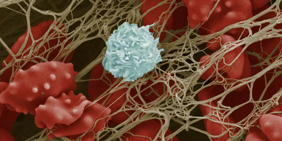 White and Red Blood Cells - image courtesy of the EM Unit