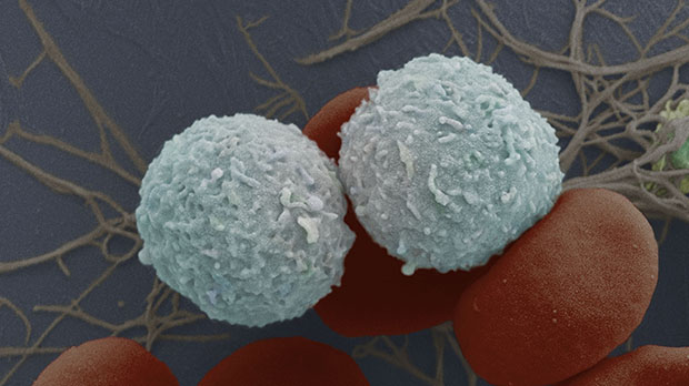An electron microscope image of white blood cells
