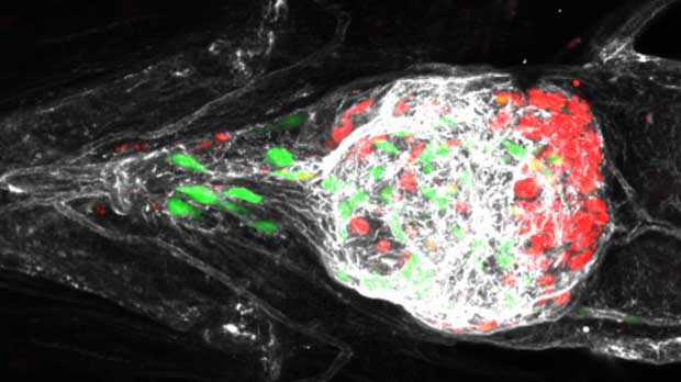 Fluorescent melanoma cells in zebrafish - image from Dr Claudia Wellbrock