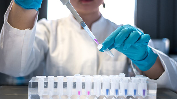 A woman in a lab filling up multiple small tubes with liquid using a pipette